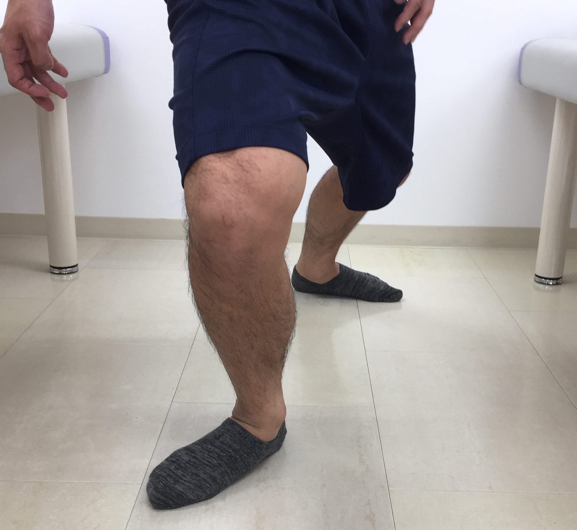 toe out knee in　腸脛靭帯炎　早く治す