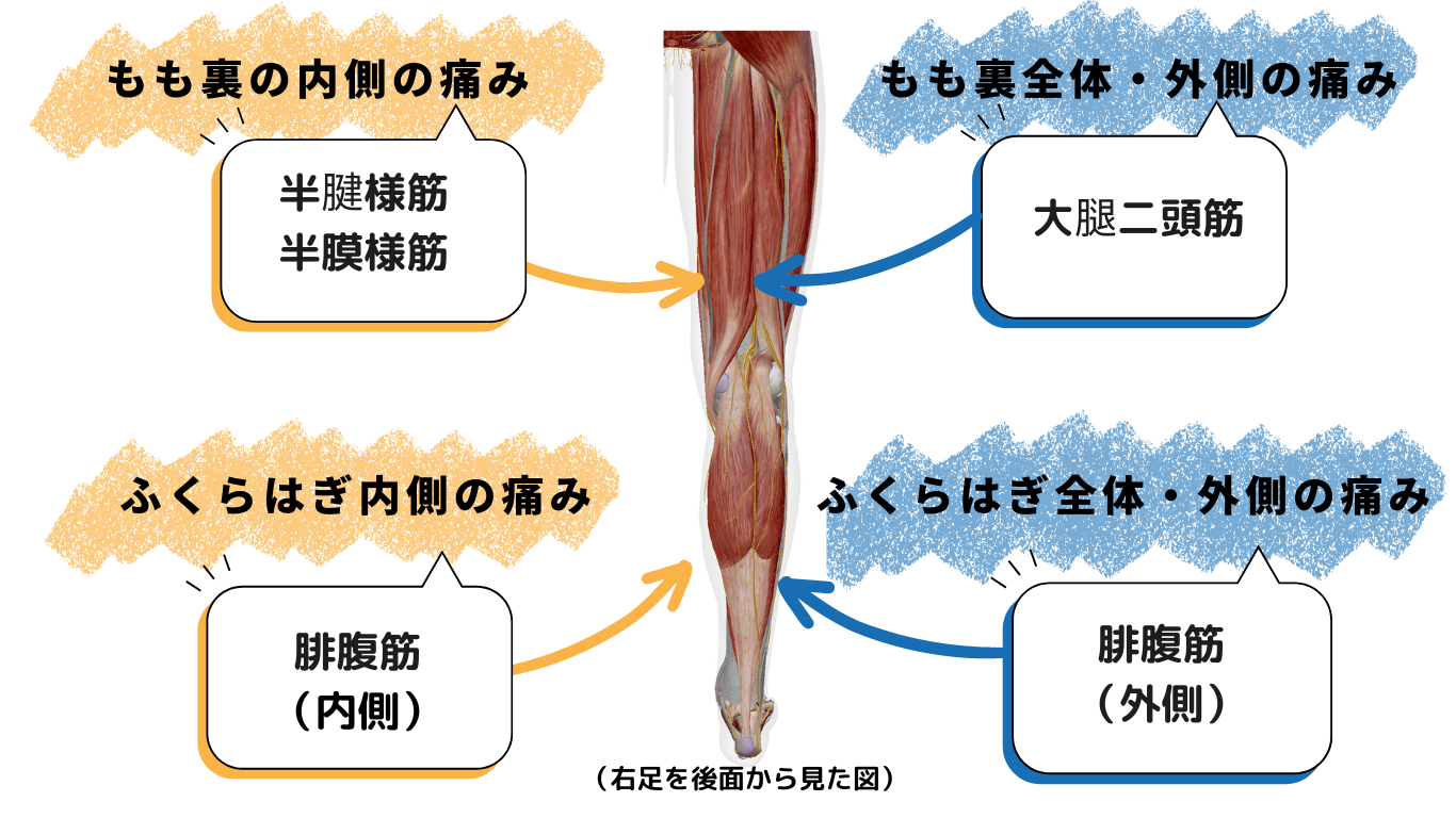 ランニング 膝裏の痛み 原因 対処法