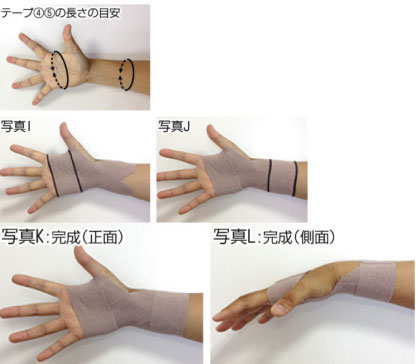 方法 手首 を 治す 捻挫 の 早く 手首の捻挫の症状と治療するための方法5つ