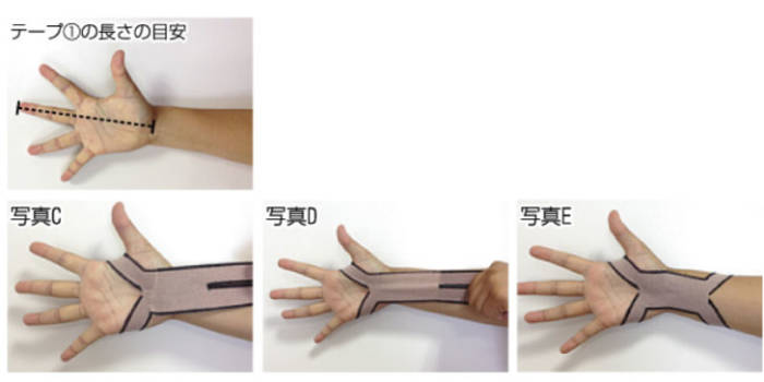 手をつくと手首が痛い原因は 真ん中 親指側 小指側など全ての痛みを解説 青山筋膜整体 理学body