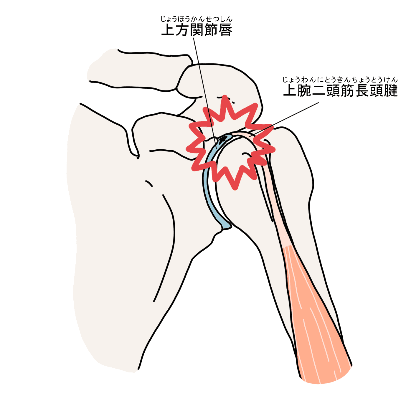 野球 肩 の 痛み